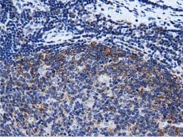 RIT2 / RIN Antibody (clone OTI3F4)