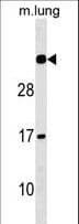 NAT15 Antibody (aa133-160)