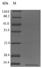 Human LST1 Protein (Recombinant 6His, N-terminus)