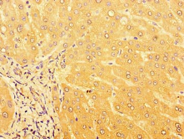 GPR179 Antibody