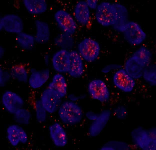USP1 Antibody (aa450-500)