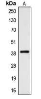Polyclonal Rabbit anti-Human CYSLT2 / CYSLTR2 Antibody (C-Terminus, WB)