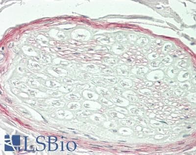 IHC-plus™ COL4A2 / Collagen IV Alpha2 Antibody (N-Terminus)