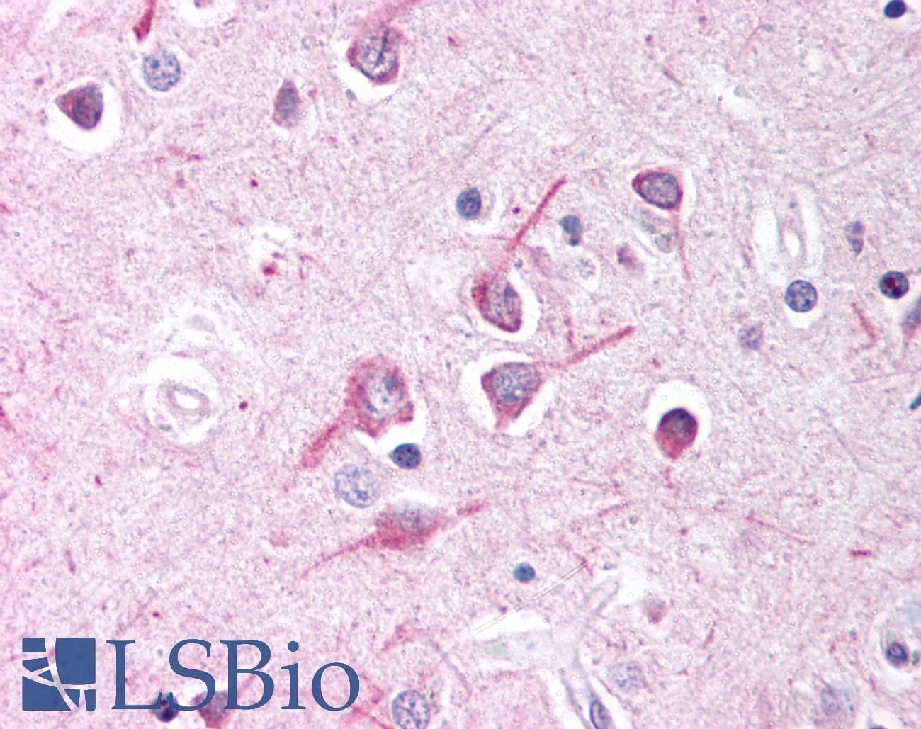 IHC-plus™ AFF1 / AF4 Antibody (aa1190-1203)