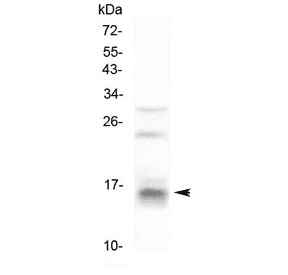 Polyclonal Rabbit anti-Human CDA / Cytidine Deaminase Antibody (IHC, WB)