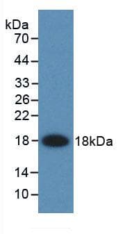I-FABP / FABP2 Antibody (aa2-132)