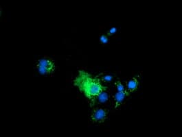 P5CR2 / PYCR2 Antibody (clone OTI5B7)
