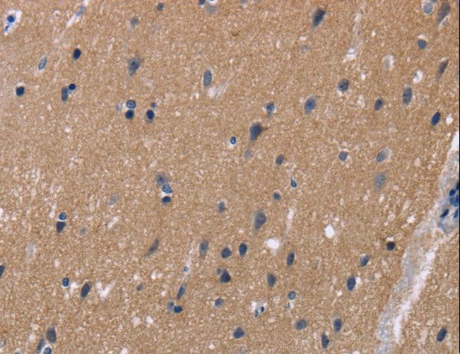 KCNJ11 / Kir6.2 Antibody