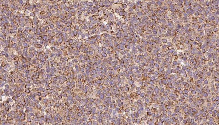 SLC30A3 / ZNT3 Antibody