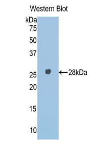 A1BG Antibody (aa22-219)