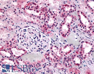 IHC-plus™ SUCNR1 / GPR91 Antibody (C-Terminus)