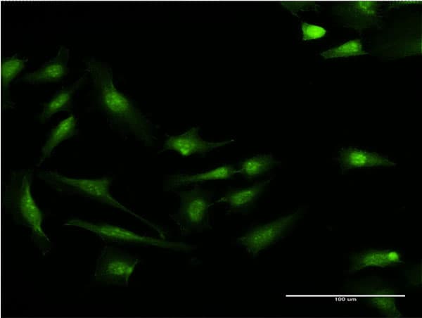 Monoclonal Mouse anti-Human S100P Antibody (clone 4E7, aa1-95, IF, WB)