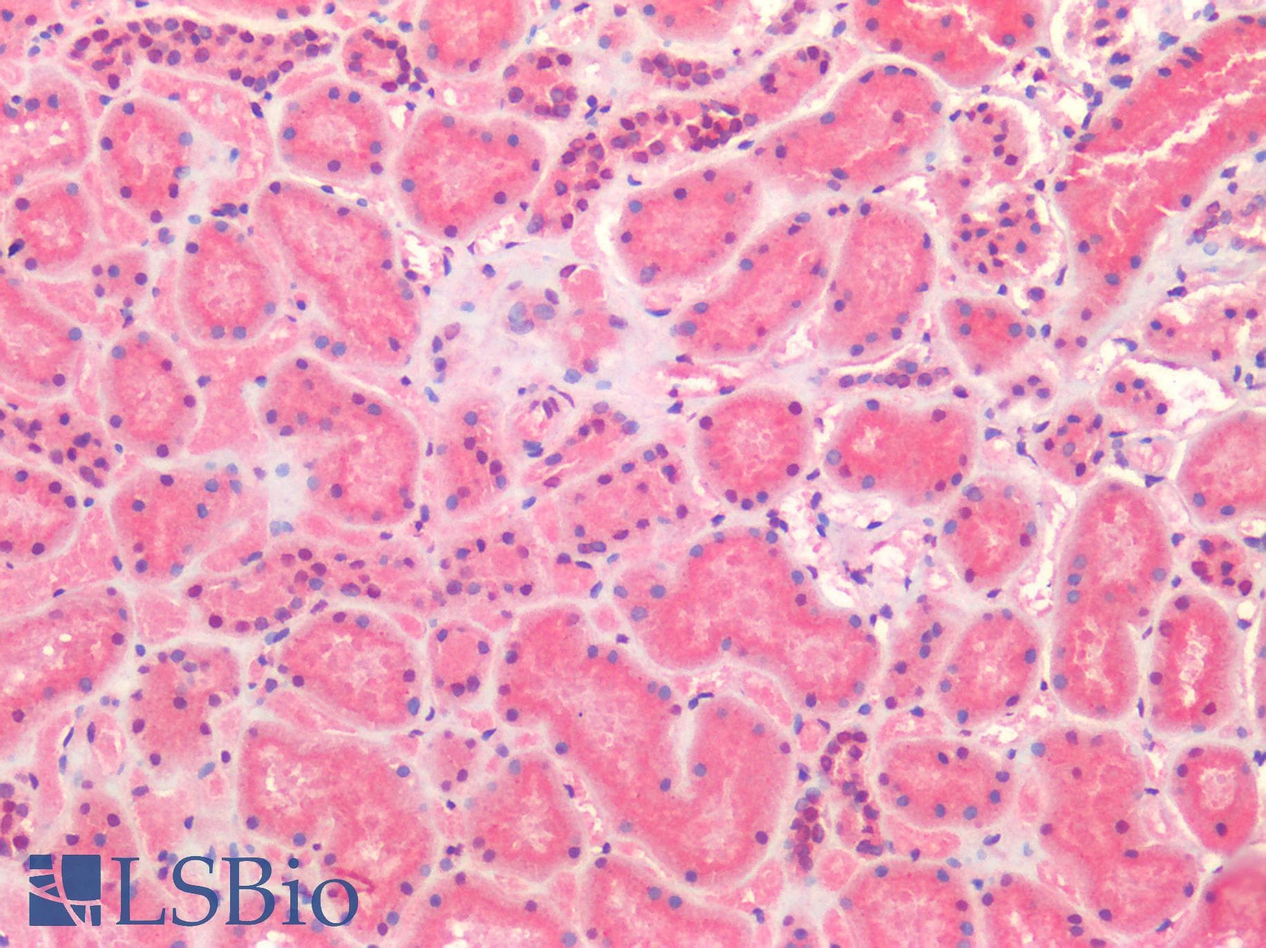 IHC-plus™ TM9SF4 Antibody (Internal)