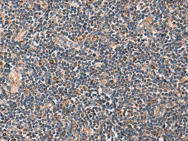 PDHA1 / PDH E1 Alpha Antibody