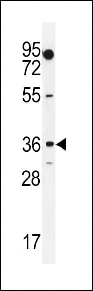 MOGAT1 / MGAT1 Antibody (aa303-335)