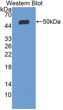 SLC27A5 / BACS Antibody (aa488-690)