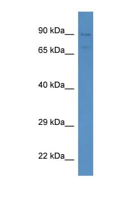 SEMA3F / Semaphorin 3F Antibody (aa227-276)