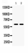 MAOB / Monoamine Oxidase B Antibody (aa448-484)