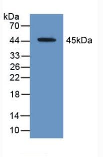 ACAT2 Antibody (aa1-397, PE)
