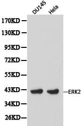 Polyclonal Rabbit anti-Human ERK1 + ERK2 Antibody (IHC, WB)