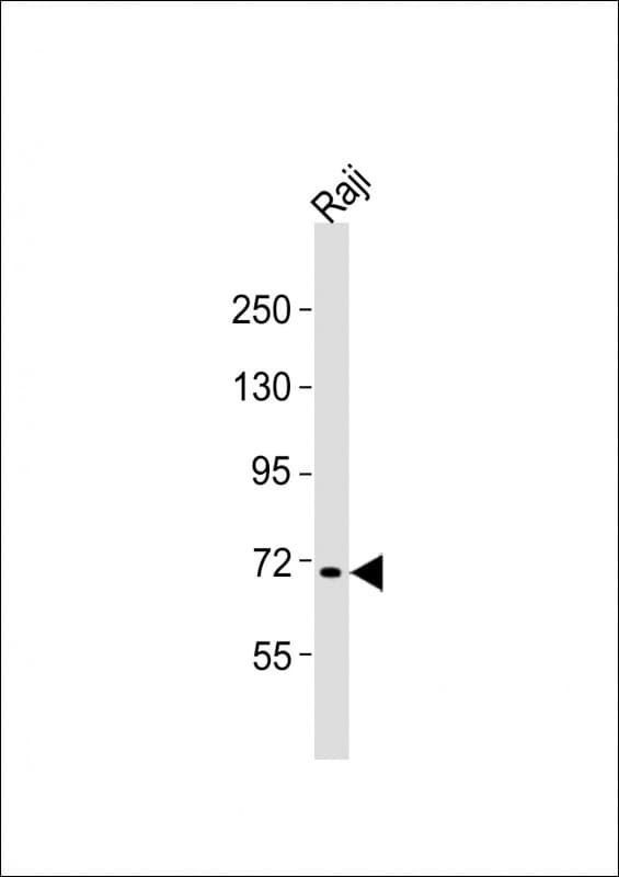 Polyclonal Rabbit anti-Human FBXW7 / FBW7 Antibody (aa177-208, WB)