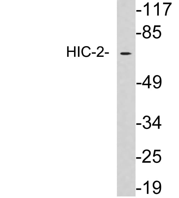 Polyclonal Rabbit anti-Human HIC2 Antibody (aa135-184, WB)