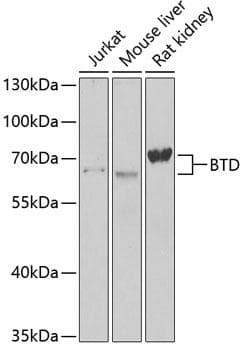 BTD / Biotinidase Antibody
