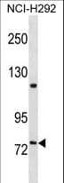 KIND2 / FERMT2 Antibody (aa641-669)