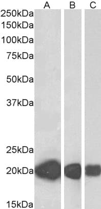 IHC-plus™ Polyclonal Goat anti-Human CSRP3 Antibody (aa150-163, IHC, WB)