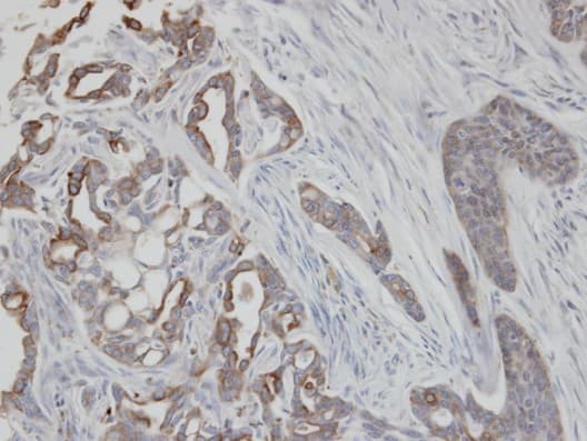 KRT2 / CK2 / Cytokeratin 2 Antibody (aa143-529)