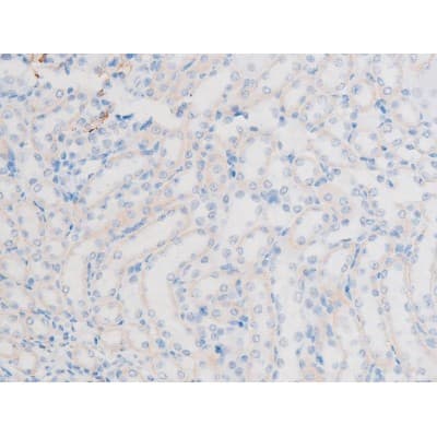 LIMK1 / LIMK Antibody (phospho-Thr508)