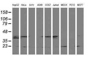Monoclonal Mouse anti-Human LSM1 Antibody (clone OTI5C6, IHC, IF, WB)