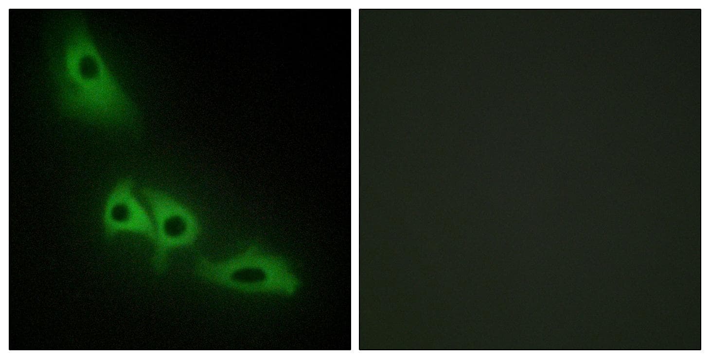 GK / Glycerol Kinase Antibody