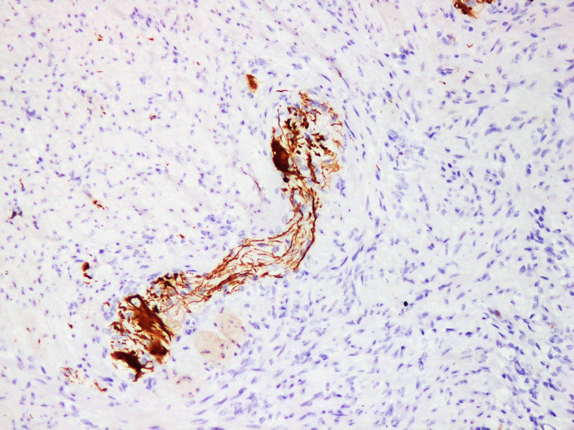 Neurofilament Antibody