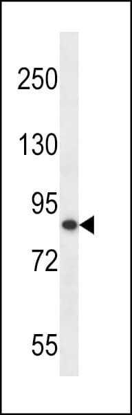 OTUD7B / Cezanne Antibody (aa757-784)
