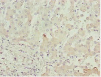ADPGK Antibody