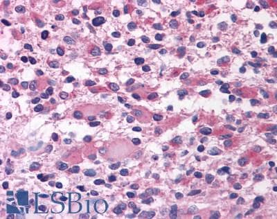 PathPlus™ GPR80 / GPR99 / OXGR1 Antibody (N-Terminus)