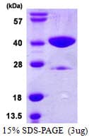 Human GLYAT Protein (Recombinant His)
