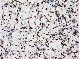 LOX / Lysyl Oxidase Antibody (clone OTI9G2)