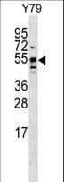 Polyclonal Rabbit anti-Human BRUNOL5 / CELF5 Antibody (aa195-222, WB)
