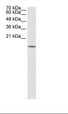HDAC6 Antibody (aa69-118)