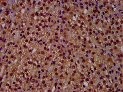 RECQL4 Antibody