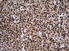 Monoclonal Mouse anti-Human NBN / Nibrin Antibody (clone OTI8E7, IHC, WB)