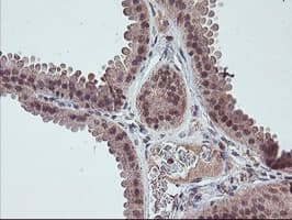 FMR1 / FMRP Antibody (clone OTI2C3)