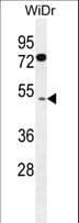 Polyclonal Rabbit anti-Human FAM82B Antibody (aa76-104, IHC, WB)