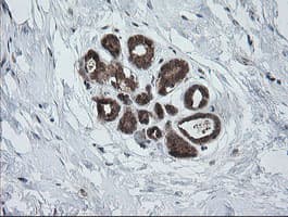 Monoclonal Mouse anti-Human PIK3CG / PI3K Gamma Antibody (clone OTI2B1, IHC, WB)