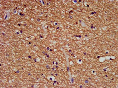 Bis(5'-adenosyl)-triphosphatase Antibody
