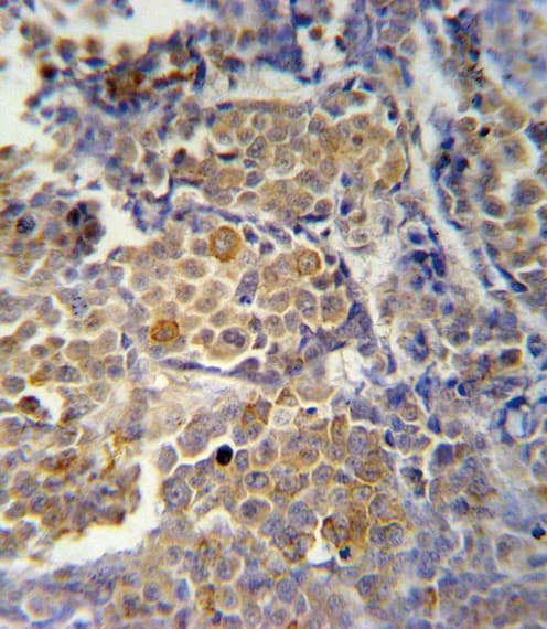 Polyclonal Rabbit anti-Human KIR2DS2 / CD158j Antibody (aa39-65, IHC, WB)