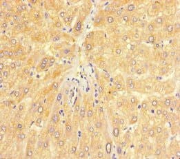 Polyclonal Rabbit anti-Human CHD4 Antibody (IHC, IF)