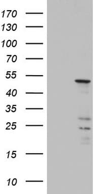 KRT20 / CK20 / Cytokeratin 20 Antibody (clone OTI6B9)